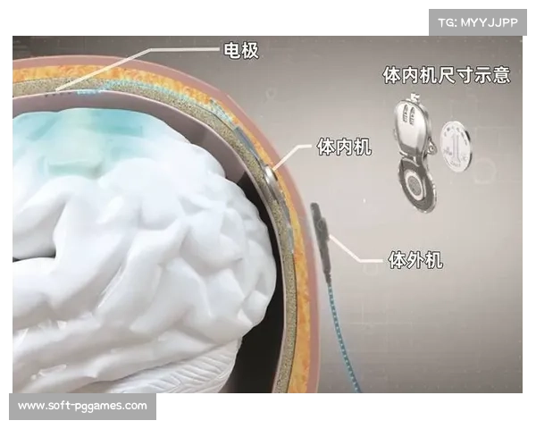 脑机接口技术前景 探索终极互动 脑机接口技术前景 探索终极互动